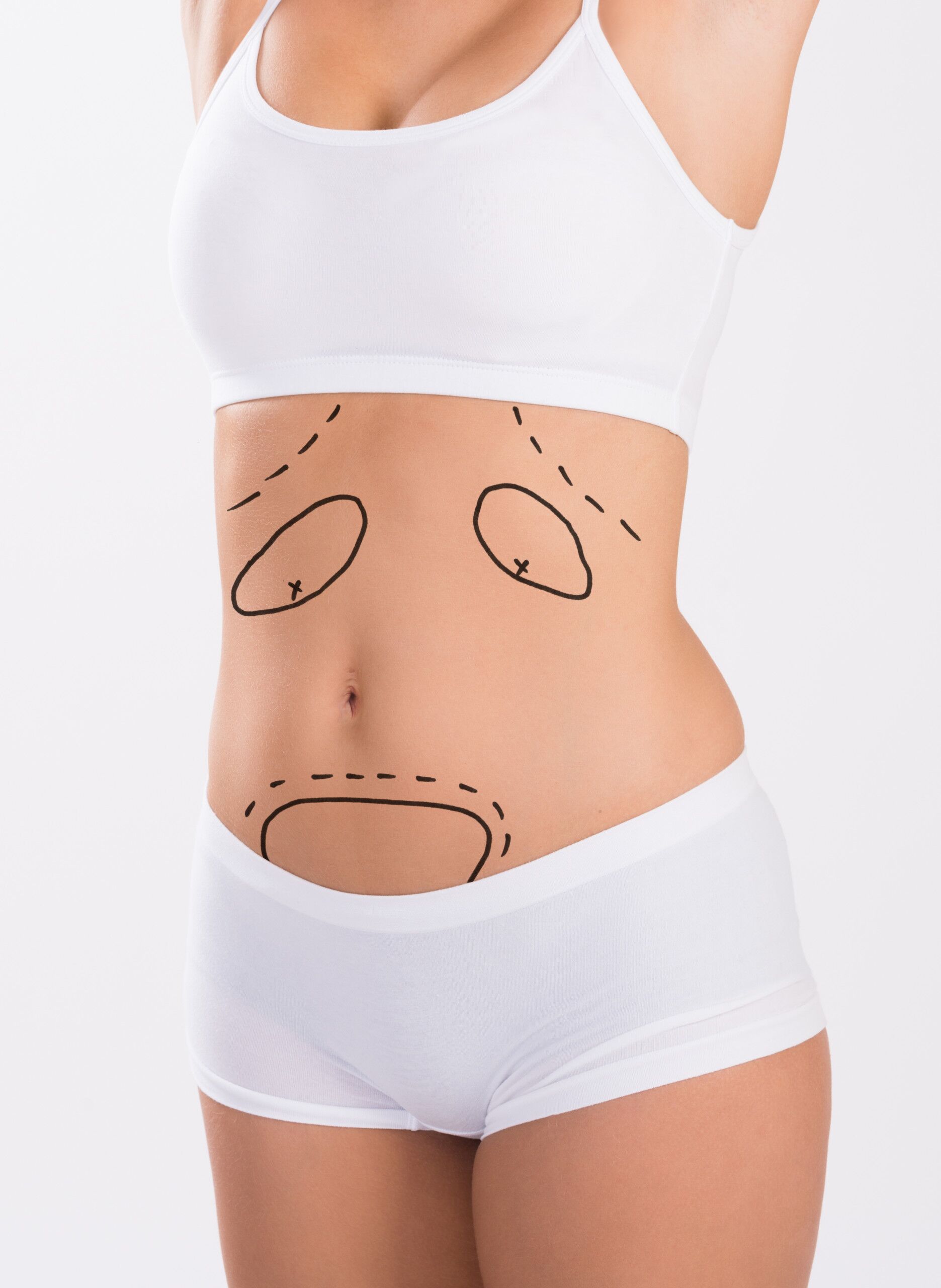 What is the Cost of a Tummy Tuck in NJ? A Doctor Explains